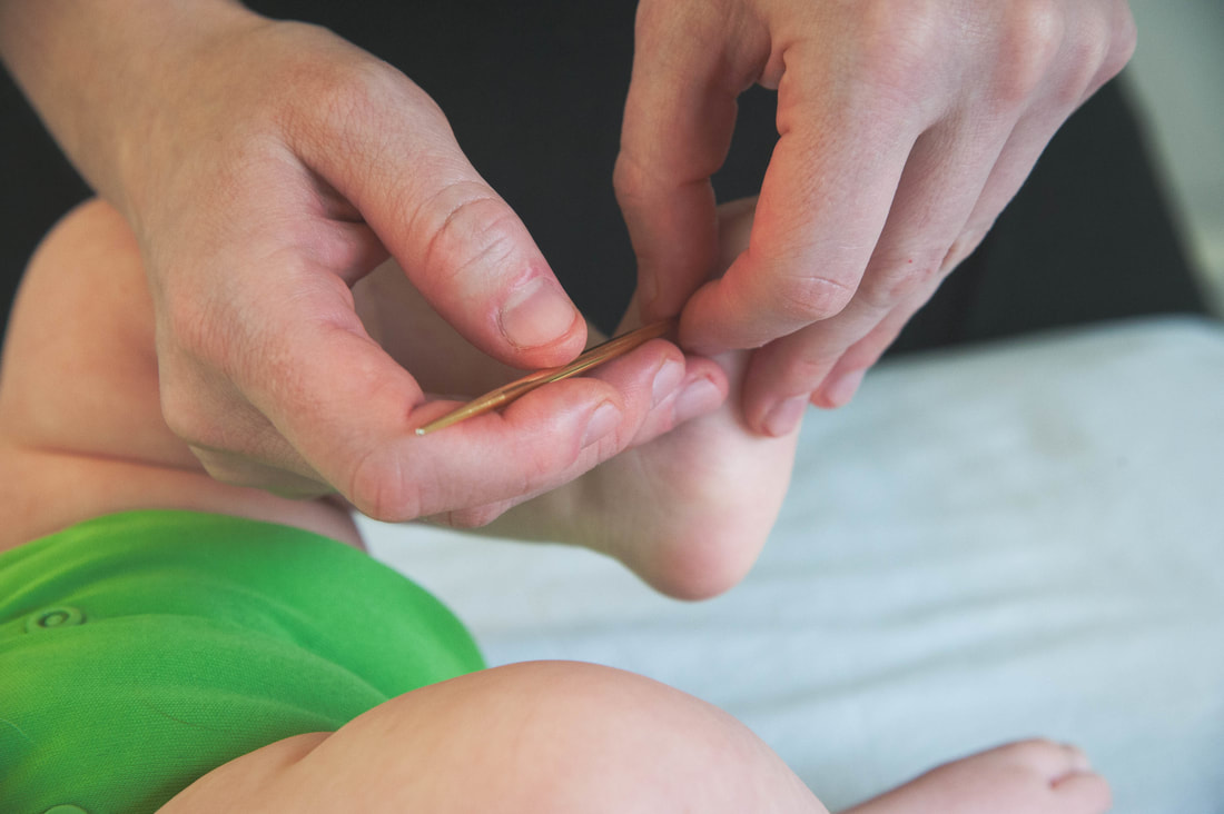 Image shows practitioner using a teishin on a baby's foot.