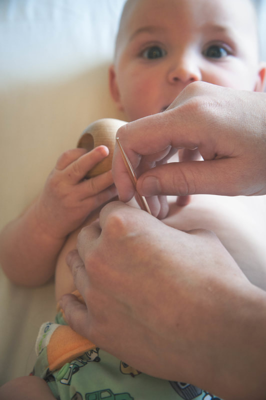 Image shows acupuncturist using a teishin on a baby's belly.